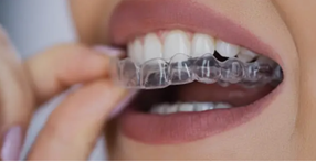 Invisalign Adelaide